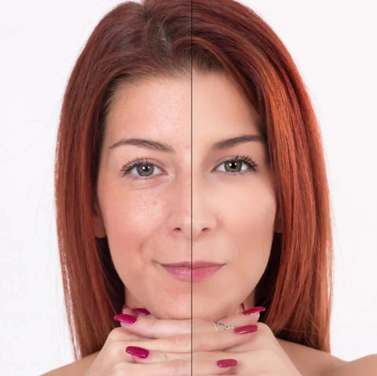 Collagen Boosting Facial